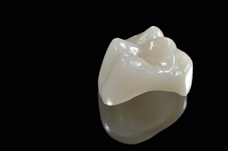 Porcelain Crowns  Granada Hills, CA