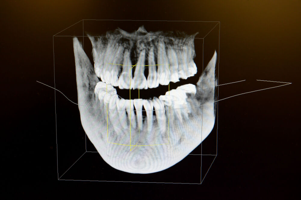 3D Imaging  Granada Hills, CA